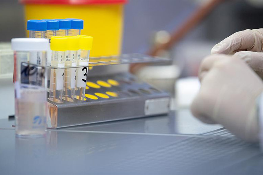 Новини Вінниці / На Вінниччину доставлено 1270 доз вакцини проти COVID-19