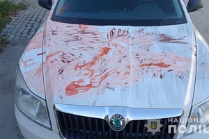 Новости Винницы и области / Поліція затримала 34-річного чоловіка, який наїхав на вінницького волонтера біля дитсадка / Інформаційний портал На Париже Новини Вінниці / Поліція затримала 34-річного чоловіка, який наїхав на вінницького волонтера біля дитсадка