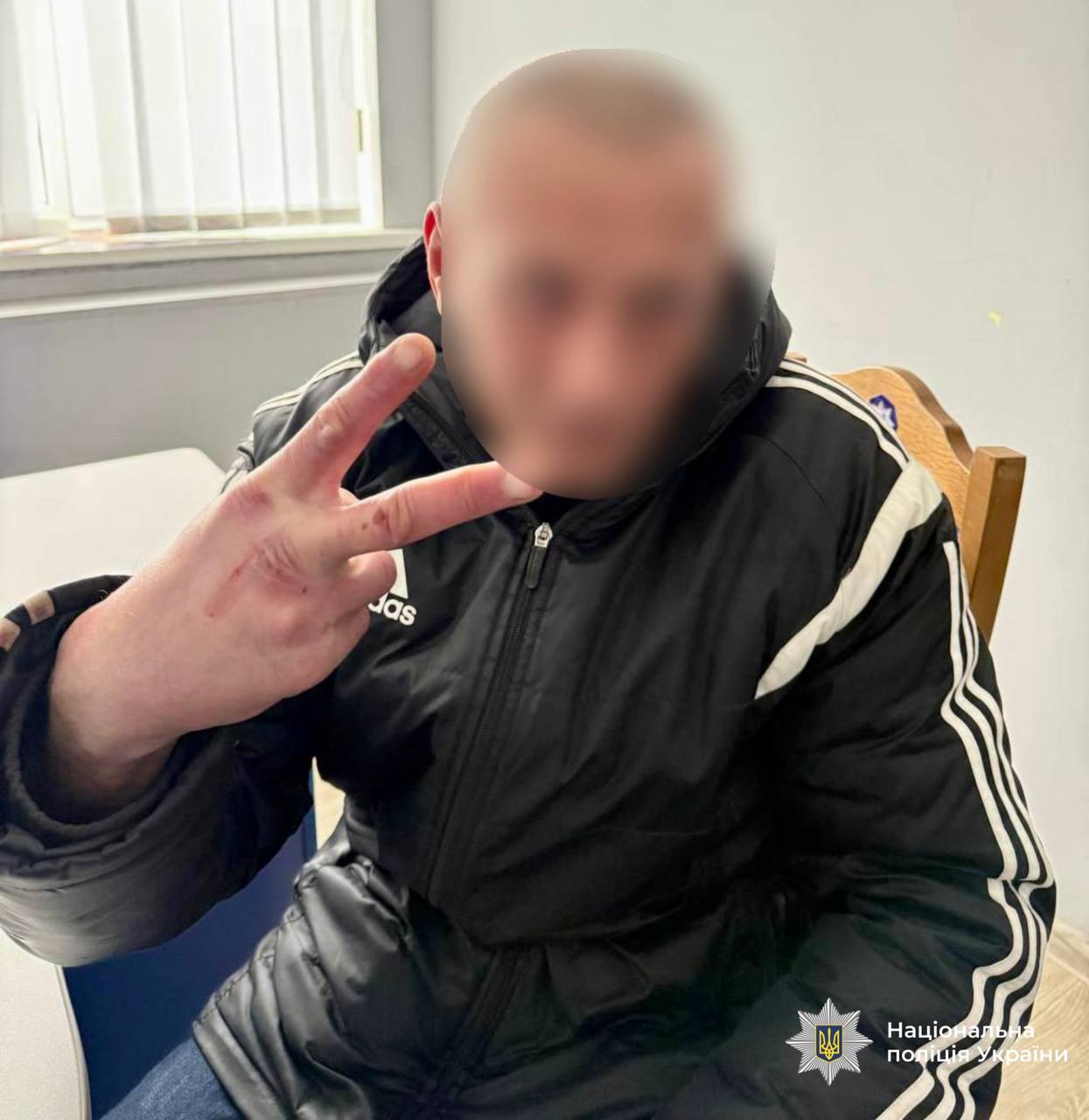 Новини Вінниці / У Хмільнику чоловік обікрав в лікарні військового, який проходив реабілітацію