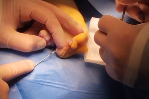 Новости Винницы и области / У Вінниці провели унікальну операцію однорічному хлопчику з рідкісною вадою рук / Інформаційний портал На Париже Новини Вінниці / У Вінниці провели унікальну операцію однорічному хлопчику з рідкісною вадою рук