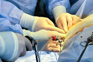 Новини Вінниці / У Вінниці успішно прооперували двох дітей з складними пухлинами грудної клітки