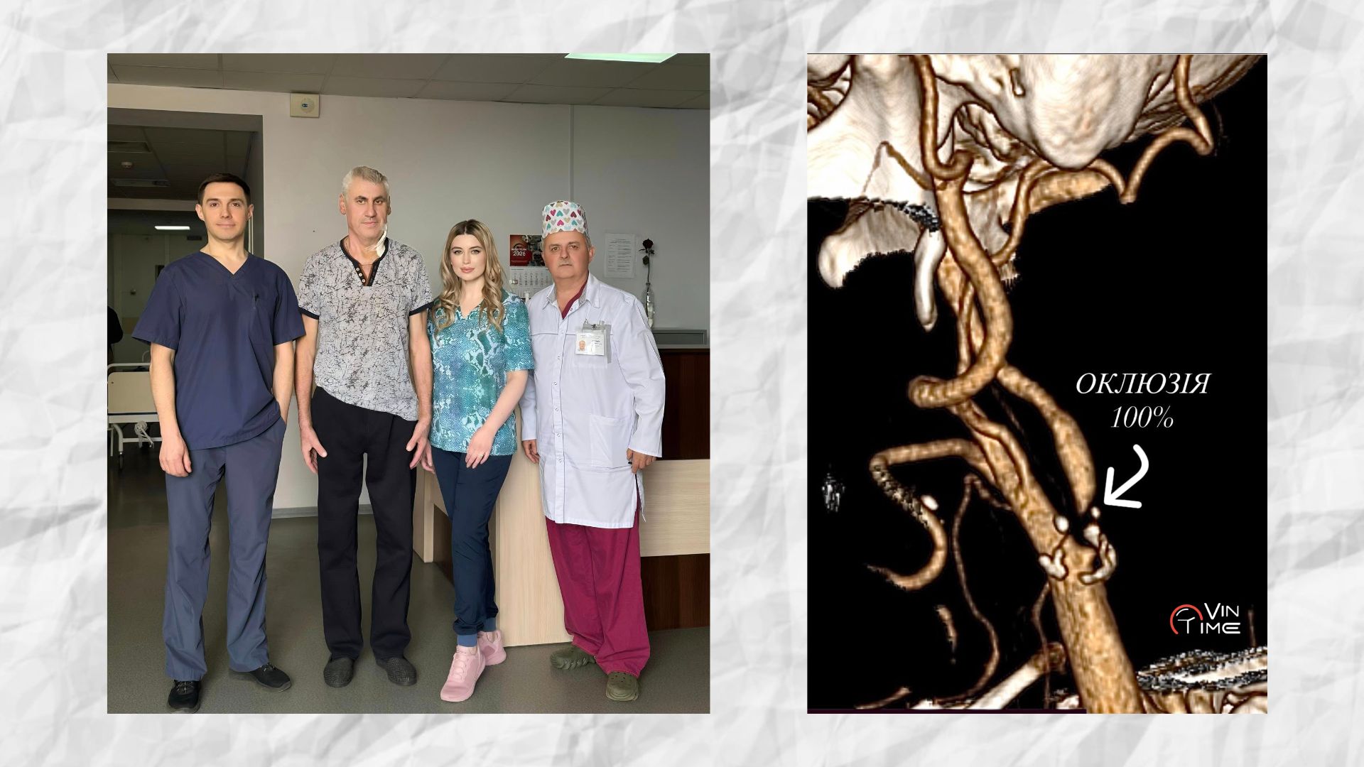 Новини Вінниці / У Вінницькій лікарні Пирогова відновили кровообіг мозку пацієнта з високим ризиком інсульту