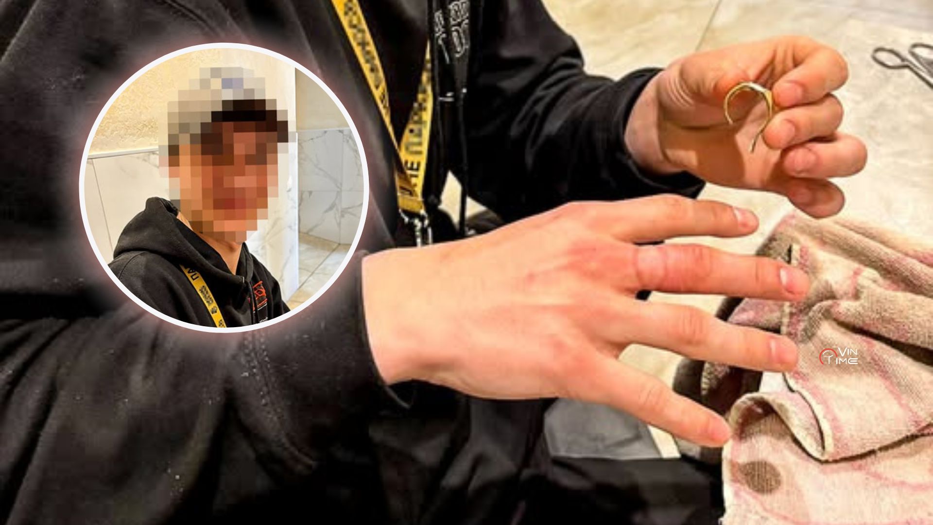 Новини Вінниці / У Вінниці рятувальники допомогли 20-річному хлопцю зняти перстень, що перетиснув палець