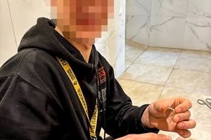 Новини Вінниці / У Вінниці рятувальники допомогли 20-річному хлопцю зняти перстень, що перетиснув палець